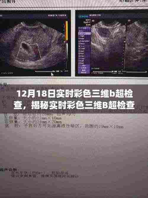 12月18日实时彩色三维B超检查,科技前沿的探秘之旅