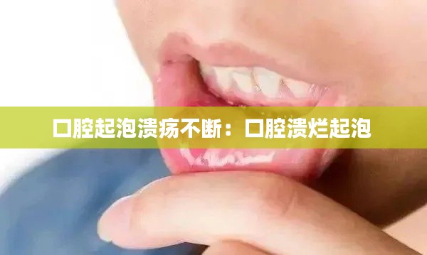 口腔起泡溃疡不断:口腔溃烂起泡