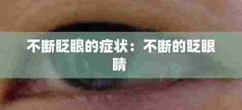 不断眨眼的症状:不断的眨眼睛