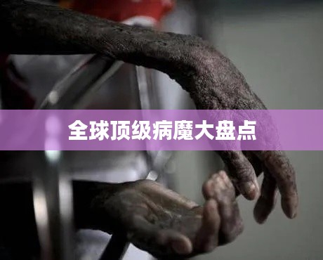 全球顶级病魔大盘点