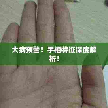 大病预警!手相特征深度解析!