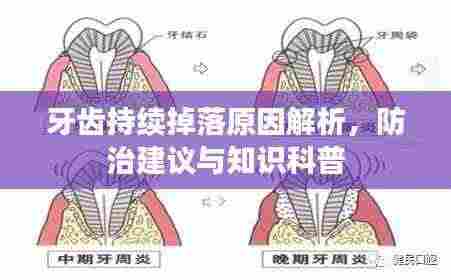 牙齿持续掉落原因解析,防治建议与知识科普